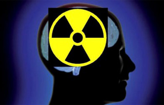 İyonlaştırıcı Radyasyon Nedir?